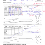 Carotid Worksheet Example –
