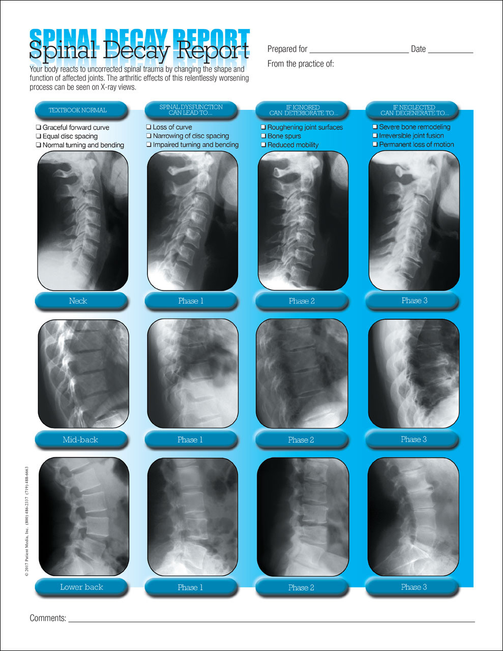Spinal Decay Patient Form Within Chiropractic X Ray Report Template