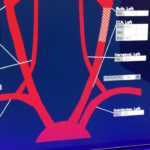 VIDEO: Carotid Artery Reporting Template Example DAIC Inside Carotid Ultrasound Report Template